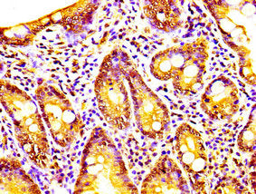 IHC image of the antibody diluted at 1:200 and staining in paraffin-embedded human small intestine tissue performed on a Leica BondTM system. After dewaxing and hydration, antigen retrieval was mediated by high pressure in a citrate buffer (pH 6.0). Section was blocked with 10% normal goat serum 30min at RT. Then primary antibody (1% BSA) was incubated at 4°C overnight. The primary is detected by a biotinylated secondary antibody and visualized using an HRP conjugated SP system.