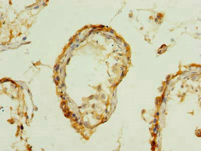 Immunohistochemistry of paraffin-embedded human testis tissue using PDIA5 Antibody at dilution of 1:100Rabbit anti-Human PDIA5 Polyclonal Antibody