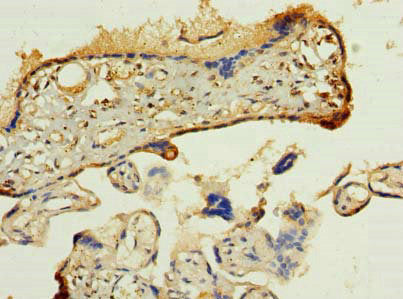 Immunohistochemistry of paraffin-embedded human placenta tissue using PDIA5 Antibody at dilution of 1:100Rabbit anti-Human PDIA5 Polyclonal Antibody