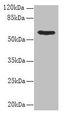 Western blot  | All lanes: PDIA5 antibody at 8µg/ml + Hela whole cell lysate  | Secondary  | Goat polyclonal to rabbit IgG at 1/10000 dilution  | Predicted band size: 60, 31 kDa  | Observed band size: 60 kDaRabbit anti-Human PDIA5 Polyclonal Antibody