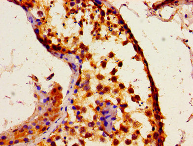 Immunohistochemistry of paraffin-embedded human testis tissue using ITPR1 Antibody at dilution of 1:100