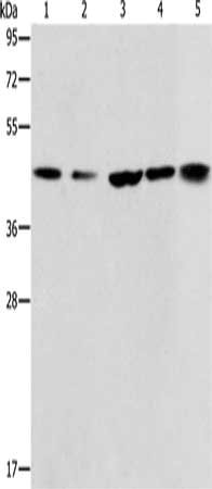 Gel: 10%SDS-PAGE, Lysate: 40 μg, Lane 1-5: Hela cells, A549 cells, NIH/3T3 cells, A172 cells, human liver cancer tissue, Primary antibody: ACAA2 Antibody(ACAA2 Antibody) at dilution 1/225, Secondary antibody: Goat anti rabbit IgG at 1/8000 dilution, Exposure time: 20 seconds