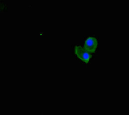 Immunofluorescent analysis of HepG2 cells using UBXN2B Antibody at dilution of 1:100 and Alexa Fluor 488-congugated AffiniPure Goat Anti-Rabbit IgG(H+L)Rabbit anti-Human UBXN2B Polyclonal Antibody