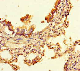 Immunohistochemistry of paraffin-embedded human lung tissue using the antibody at dilution of 1:100Rabbit anti-Human UBXN2B Polyclonal Antibody