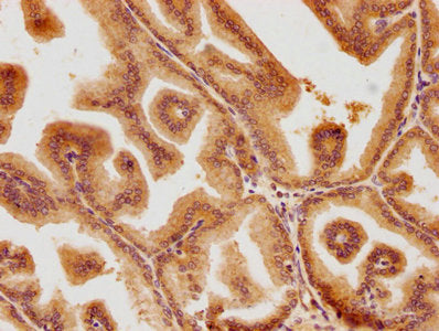 IHC image of PSMD6 Antibody diluted at 1:100 and staining in paraffin-embedded human prostate tissue performed on a Leica BondTM system. After dewaxing and hydration, antigen retrieval was mediated by high pressure in a citrate buffer (pH 6.0). Section was blocked with 10% normal goat serum 30min at RT. Then primary antibody (1% BSA) was incubated at 4°C overnight. The primary is detected by a biotinylated secondary antibody and visualized using an HRP conjugated SP system.Rabbit anti-Human PSMD6 Polyclonal Antibody