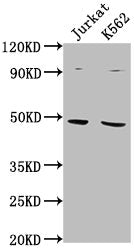 Western Blot | Positive WB detected in: Jurkat whole cell lysate, K562 whole cell lysate | All lanes: PSMD6 antibody at 1:2000 | Secondary | Goat polyclonal to rabbit IgG at 1/50000 dilution | Predicted band size: 46, 42, 52 kDa | Observed band size: 46 kDaRabbit anti-Human PSMD6 Polyclonal Antibody