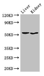 Western Blot | Positive WB detected in: Mouse liver tissue, Mouse kidney tissue | All lanes: SNX17 antibody at 3.5μg/ml | Secondary | Goat polyclonal to rabbit IgG at 1/50000 dilution | Predicted band size: 53, 50 kDa | Observed band size: 53 kDaRabbit anti-Human SNX17 Polyclonal Antibody
