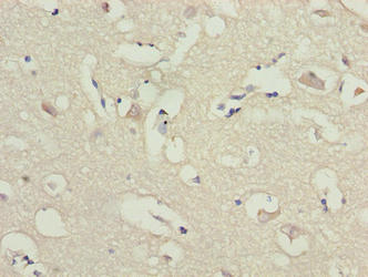 Immunohistochemistry of paraffin-embedded human brain tissue using the antibody at dilution of 1:100