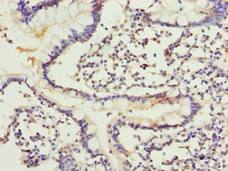 Immunohistochemistry of paraffin-embedded human small intestine tissue using ARL6IP1 Antibody at dilution of 1:100Rabbit anti-Human ARL6IP1 Polyclonal Antibody