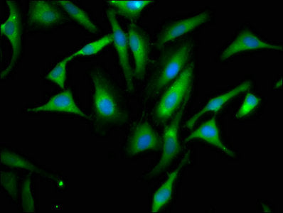 Immunofluorescence staining of Hela cells with PPA1 Antibody at 1:66, counter-stained with DAPI. The cells were fixed in 4% formaldehyde, permeabilized using 0.2% Triton X-100 and blocked in 10% normal Goat Serum. The cells were then incubated with the antibody overnight at 4°C. The secondary antibody was Alexa Fluor 488-congugated AffiniPure Goat Anti-Rabbit IgG(H+L).Rabbit anti-Human PPA1 Polyclonal Antibody