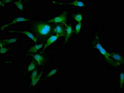 Immunofluorescence staining of Hela cells with the antibody at 1:185, counter-stained with DAPI. The cells were fixed in 4% formaldehyde, permeabilized using 0.2% Triton X-100 and blocked in 10% normal Goat Serum. The cells were then incubated with the antibody overnight at 4°C. The secondary antibody was Alexa Fluor 488-congugated AffiniPure Goat Anti-Rabbit IgG(H+L).Rabbit anti-Human RAB35 Polyclonal Antibody