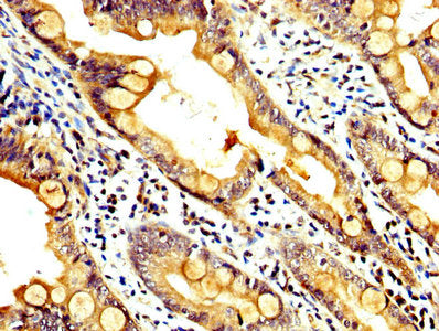 IHC image of RAB35 Antibody diluted at 1:400 and staining in paraffin-embedded human small intestine tissue performed on a Leica BondTM system. After dewaxing and hydration, antigen retrieval was mediated by high pressure in a citrate buffer (pH 6.0). Section was blocked with 10% normal goat serum 30min at RT. Then primary antibody (1% BSA) was incubated at 4°C overnight. The primary is detected by a biotinylated secondary antibody and visualized using an HRP conjugated SP system.Rabbit anti-Human RAB35 Polyclonal Antibody