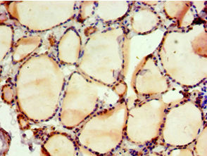 Immunohistochemistry of paraffin-embedded human thyroid tissue using NAB2 Antibody at dilution of 1:100Rabbit anti-Human NAB2 Polyclonal Antibody