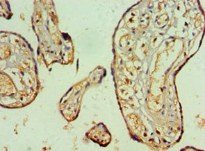 Immunohistochemistry of paraffin-embedded human placenta tissue using NAB2 Antibody at dilution of 1:100Rabbit anti-Human NAB2 Polyclonal Antibody