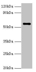 Western blot  | All lanes: NAB2 antibody at 3µg/ml + Hela whole cell lysate  | Secondary  | Goat polyclonal to rabbit IgG at 1/10000 dilution  | Predicted band size: 57, 35, 50 kDa  | Observed band size: 57 kDaRabbit anti-Human NAB2 Polyclonal Antibody