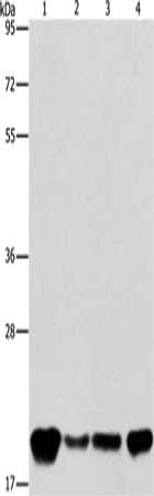 Gel: 8%SDS-PAGE, Lysate: 40 μg, Lane 1-4: A549 cells, K562 cells, hela cells, hepG2 cells, Primary antibody: PEBP1 Antibody(PEBP1 Antibody) at dilution 1/400, Secondary antibody: Goat anti rabbit IgG at 1/8000 dilution, Exposure time: 40 secondsRabbit anti-Human PEBP1 Polyclonal Antibody