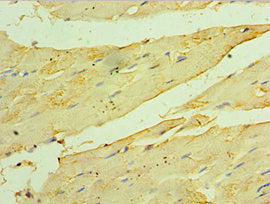 Immunohistochemistry of paraffin-embedded human skeletal muscle tissue using HSPB2 Antibody at dilution of 1:100Rabbit anti-Human HSPB2 Polyclonal Antibody