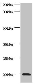 Western blot | All lanes: Heat shock protein beta-2 antibody at 3μg/ml + Mouse skeletal muscle tissue | Secondary | Goat polyclonal to rabbit IgG at 1/10000 dilution | Predicted band size: 20 kDa | Observed band size: 20 kDaRabbit anti-Human HSPB2 Polyclonal Antibody