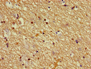Immunohistochemistry of paraffin-embedded human brain tissue using DPYSL2 Antibody at dilution of 1:100Rabbit anti-Human DPYSL2 Polyclonal Antibody