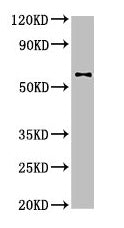 Western Blot  | Positive WB detected in: U87 whole cell lysate  | All lanes: DPYSL2 antibody at 4µg/ml  | Secondary  | Goat polyclonal to rabbit IgG at 1/50000 dilution  | Predicted band size: 63, 59 kDa  | Observed band size: 63 kDaRabbit anti-Human DPYSL2 Polyclonal Antibody