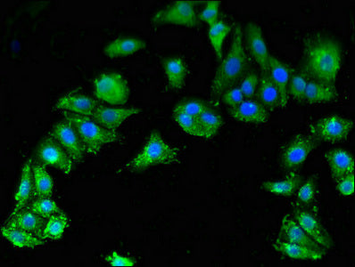Immunofluorescent analysis of HepG2 cells using SMN1 Antibody at dilution of 1:100 and Alexa Fluor 488-congugated AffiniPure Goat Anti-Rabbit IgG(H+L)Rabbit anti-Human SMN1 Polyclonal Antibody