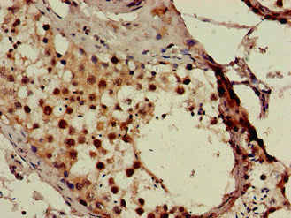 Immunohistochemistry of paraffin-embedded human testis tissue using SMN1 Antibody at dilution of 1:100Rabbit anti-Human SMN1 Polyclonal Antibody