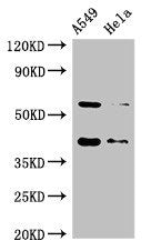 Western Blot  | Positive WB detected in: A549 whole cell lysate, Hela whole cell lysate  | All lanes: SMN1 antibody at 2µg/ml  | Secondary  | Goat polyclonal to rabbit IgG at 1/50000 dilution  | Predicted band size: 32, 29, 31, 28 kDa  | Observed band size: 40, 60 kDaRabbit anti-Human SMN1 Polyclonal Antibody