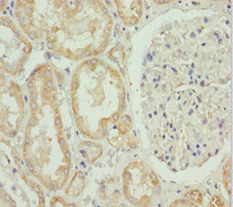 Immunohistochemistry of paraffin-embedded human kidney tissue using HADH Antibody at dilution of 1:100Rabbit anti-Human HADH Polyclonal Antibody