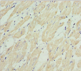 Immunohistochemistry of paraffin-embedded human heart tissue using HADH Antibody at dilution of 1:100Rabbit anti-Human HADH Polyclonal Antibody