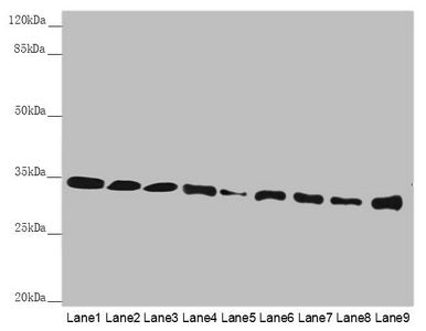 Western blot  | All lanes: HADH antibody at 2.38µg/ml  | Lane 1: Mouse heart tissue  | Lane 2: Mouse liver tissue  | Lane 3: Mouse kidney tissue  | Lane 4: Mouse skeletal muscle tissue  | Lane 5: NIH/3T3 whole cell lysate  | Lane 6: Hela whole cell lysate  | Lane 7: 293T whole cell lysate  | Lane 8: A431 whole cell lysate  | Lane 9: Jurkat whole cell lysate  | Secondary  | Goat polyclonal to rabbit IgG at 1/10000 dilution  | Predicted band size: 35, 43, 37 kDa  | Observed band size: 35 kDaRabbit anti-Human HADH Polyclonal Antibody