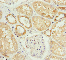 Immunohistochemistry of paraffin-embedded human kidney tissue using HADH Antibody at dilution of 1:100Rabbit anti-Human HADH Polyclonal Antibody