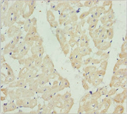 Immunohistochemistry of paraffin-embedded human heart tissue using HADH Antibody at dilution of 1:100Rabbit anti-Human HADH Polyclonal Antibody