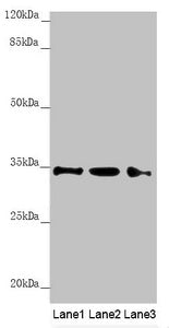 Western blot | All lanes: HADH antibody at 1.21 μg/ml | Lane 1: Mouse heart tissue | Lane 2: Mouse liver tissue | Lane 3: Mouse kidney tissue | Secondary | Goat polyclonal to rabbit IgG at 1/10000 dilution | Predicted band size: 35, 43, 37 kDa | Observed band size: 35 kDaRabbit anti-Human HADH Polyclonal Antibody