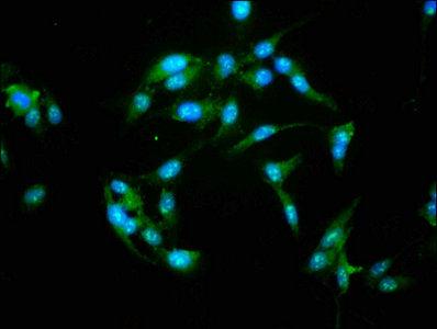 Immunofluorescence staining of Hela cells with NFATC3 Antibody at 1:155, counter-stained with DAPI. The cells were fixed in 4% formaldehyde, permeabilized using 0.2% Triton X-100 and blocked in 10% normal Goat Serum. The cells were then incubated with the antibody overnight at 4°C. The secondary antibody was Alexa Fluor 488-congugated AffiniPure Goat Anti-Rabbit IgG(H+L).Rabbit anti-Human NFATC3 Polyclonal Antibody