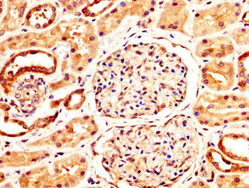 IHC image of NFATC3 Antibody diluted at 1:400 and staining in paraffin-embedded human kidney tissue performed on a Leica BondTM system. After dewaxing and hydration, antigen retrieval was mediated by high pressure in a citrate buffer (pH 6.0). Section was blocked with 10% normal goat serum 30min at RT. Then primary antibody (1% BSA) was incubated at 4°C overnight. The primary is detected by a biotinylated secondary antibody and visualized using an HRP conjugated SP system.Rabbit anti-Human NFATC3 Polyclonal Antibody