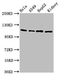 Western Blot  | Positive WB detected in: Hela whole cell lysate, A549 whole cell lysate, HepG2 whole cell lysate, Rat kidney tissue  | All lanes: NFATC3 antibody at 4.6µg/ml  | Secondary  | Goat polyclonal to rabbit IgG at 1/50000 dilution  | Predicted band size: 116, 113, 78, 81 kDa  | Observed band size: 116 kDaRabbit anti-Human NFATC3 Polyclonal Antibody
