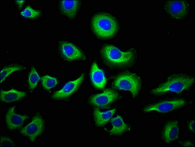 Immunofluorescence staining of A549 cells with NAIP Antibody at 1:66, counter-stained with DAPI. The cells were fixed in 4% formaldehyde, permeabilized using 0.2% Triton X-100 and blocked in 10% normal Goat Serum. The cells were then incubated with the antibody overnight at 4°C. The secondary antibody was Alexa Fluor 488-congugated AffiniPure Goat Anti-Rabbit IgG(H+L).Rabbit anti-Human NAIP Polyclonal Antibody