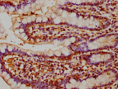IHC image of NAIP Antibody diluted at 1:200 and staining in paraffin-embedded human small intestine tissue performed on a Leica BondTM system. After dewaxing and hydration, antigen retrieval was mediated by high pressure in a citrate buffer (pH 6.0). Section was blocked with 10% normal goat serum 30min at RT. Then primary antibody (1% BSA) was incubated at 4°C overnight. The primary is detected by a biotinylated secondary antibody and visualized using an HRP conjugated SP system.Rabbit anti-Human NAIP Polyclonal Antibody
