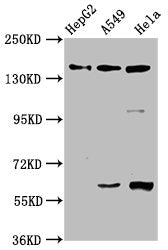 Western BlotPositive WB detected in: HepG2 whole cell lysate, A549 whole cell lysate, Hela whole cell lysateAll lanes: NAIP antibody at 3.3µg/mlSecondaryGoat polyclonal to rabbit IgG at 1/50000 dilutionPredicted band size: 160, 142 kDaObserved band size: 160 kDaRabbit anti-Human NAIP Polyclonal Antibody
