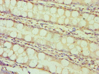 Immunohistochemistry of paraffin-embedded human colon tissue using BAMBI Antibody at dilution of 1:100