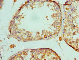 Immunohistochemistry of paraffin-embedded human testis tissue using MAP2K5 Antibody at dilution of 1:100