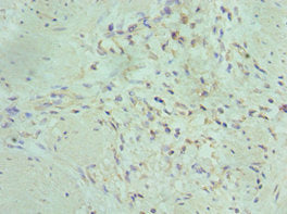 Immunohistochemistry of paraffin-embedded human gallbladder tissue using MAP2K5 Antibody at dilution of 1:100