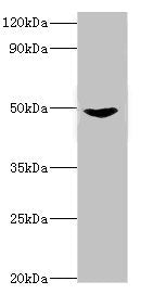 Western blot | All lanes: Dual specificity mitogen-activated protein kinase kinase 5 antibody at 2μg/ml + Rat heart tissue | Secondary | Goat polyclonal to rabbit IgG at 1/10000 dilution | Predicted band size: 51, 49, 50, 47 kDa | Observed band size: 51 kDa