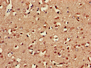 Immunohistochemistry of paraffin-embedded human brain tissue using KLRD1 Antibody at dilution of 1:100