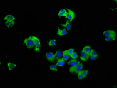 Immunofluorescence staining of MCF-7 cells with SLC14A1 Antibody at 1:66, counter-stained with DAPI. The cells were fixed in 4% formaldehyde, permeabilized using 0.2% Triton X-100 and blocked in 10% normal Goat Serum. The cells were then incubated with the antibody overnight at 4°C. The secondary antibody was Alexa Fluor 488-congugated AffiniPure Goat Anti-Rabbit IgG(H+L).Rabbit anti-Human SLC14A1 Polyclonal Antibody