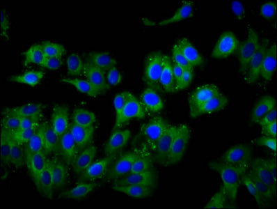 Immunofluorescence staining of HepG2 cells with TCIRG1 Antibody at 1:100, counter-stained with DAPI. The cells were fixed in 4% formaldehyde, permeabilized using 0.2% Triton X-100 and blocked in 10% normal Goat Serum. The cells were then incubated with the antibody overnight at 4°C. The secondary antibody was Alexa Fluor 488-congugated AffiniPure Goat Anti-Rabbit IgG(H+L).Rabbit anti-Human TCIRG1 Polyclonal Antibody