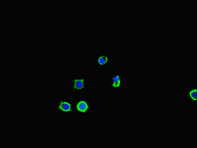 Immunofluorescent analysis of MCF-7 cells using SQSTM1 Antibody at dilution of 1:100 and Alexa Fluor 488-congugated AffiniPure Goat Anti-Rabbit IgG(H+L)Rabbit anti-Human SQSTM1 Polyclonal Antibody