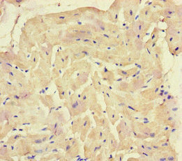 Immunohistochemistry of paraffin-embedded human heart tissue using the antibody at dilution of 1:100Rabbit anti-Human SQSTM1 Polyclonal Antibody