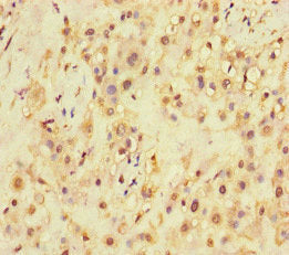 Immunohistochemistry of paraffin-embedded human placenta tissue using SQSTM1 Antibody at dilution of 1:100Rabbit anti-Human SQSTM1 Polyclonal Antibody