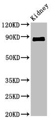 Western Blot | Positive WB detected in: Mouse kidney tissue | All lanes: CDH18 antibody at 2.4μg/ml | Secondary | Goat polyclonal to rabbit IgG at 1/50000 dilution | Predicted band size: 89, 64 kDa | Observed band size: 89 kDaRabbit anti-Human CDH18 Polyclonal Antibody